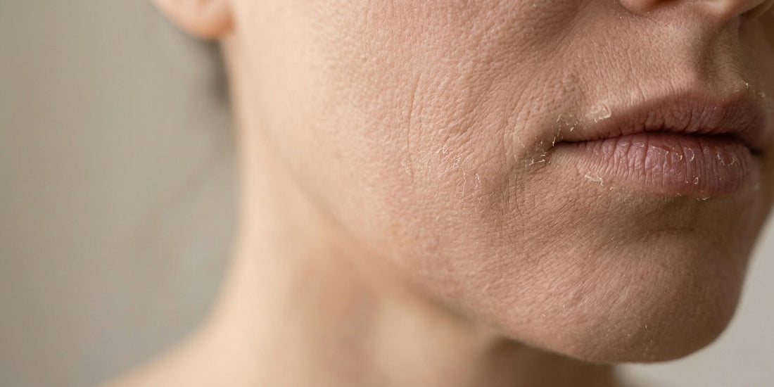 Close-up of a person's face with dry skin on a neutral background.